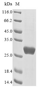 Rodent GSTP1 protein