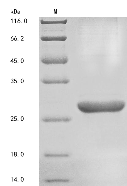 Human HSPG2 protein