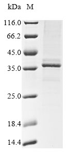 Mouse Tectb protein