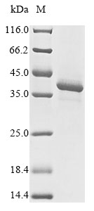 Algae Plasmepsin-2 protein