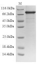 Human ABCD1 protein