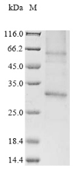 Human ADIPOR1 protein