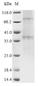 Human CCR5 protein