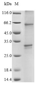 Human G protein-coupled receptor 20 variant protein