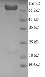 Human RPL8 protein