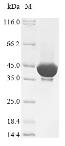 Human ASMT protein