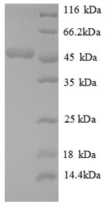 Human ATP5O protein