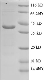 Human ATP6V1G1 protein