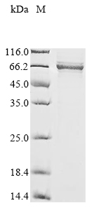 Human BCL6 protein