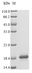 Human CKS2 protein