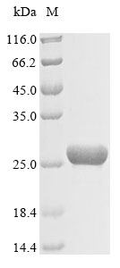 Rat Cps1 protein