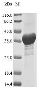 Human HER2 protein