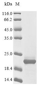 Human GRIN1 protein