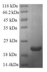 Human LGALS7 protein