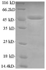 Human LIPA protein