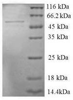 Human SERS protein