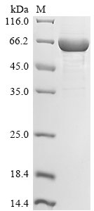 Human SLFN11 protein