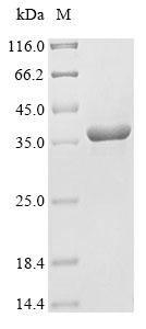 Mouse Tectb protein