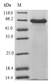 Human RNASEL protein