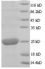 Virus UL99 protein