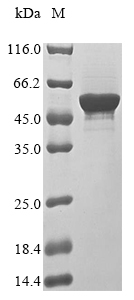 Virus Nucleo protein