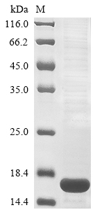 Virus Nuclear export protein