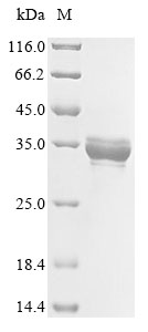 E. coli hdhA protein