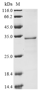 Virus US11 protein