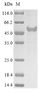 Human LAMC2 protein