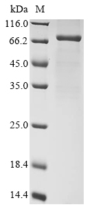 Human Desmoglein 2 protein