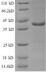 Human ATP6V1F protein