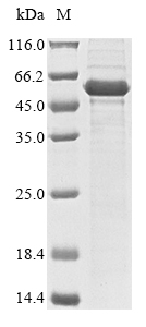 Human NR5A1 protein