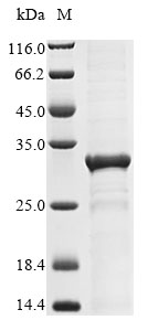 Human ARID4B protein