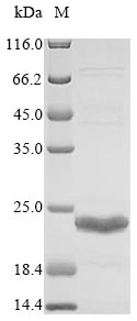 Bacteria NDM-1 protein