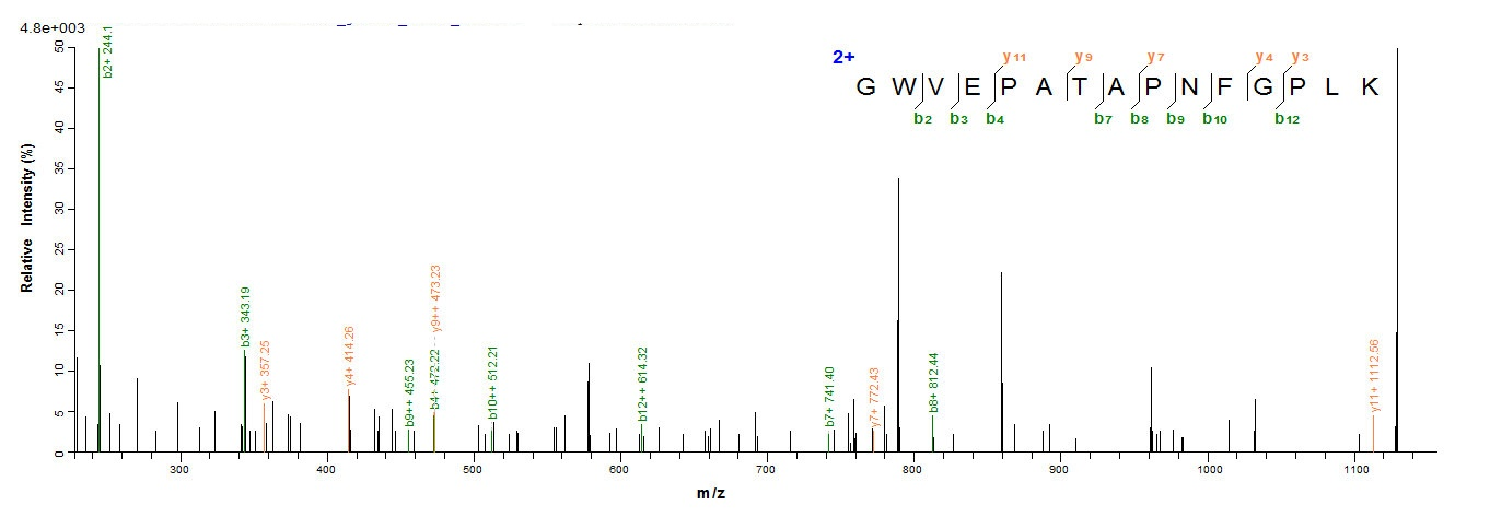 Bacteria NDM-1 protein