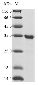 Human EGLN1 protein