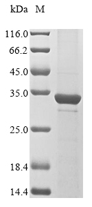 Human PRXL2A protein