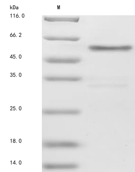 Human JAG1 protein