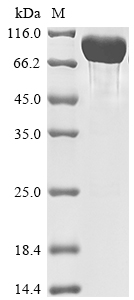 Human SIRPA protein