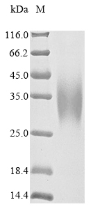 Human CPS1 protein