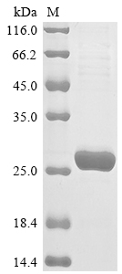 Hamster GSTP1 protein
