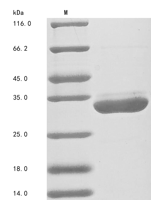 Human YWHAZ protein