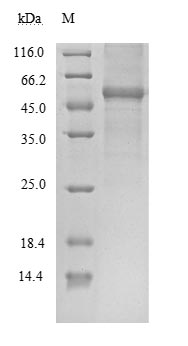 Human 2019-nCOV-N protein