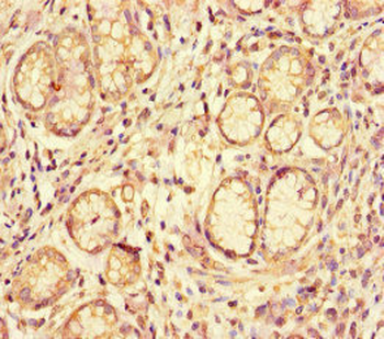 ACE2 Antibody