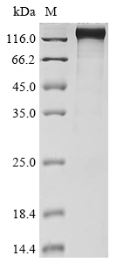 Human Nuclear pore complex protein Nup98-Nup96 protein