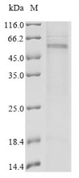 Human Transmembrane protease serine 2 protein
