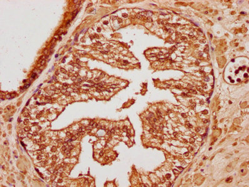 TRIM65 Antibody
