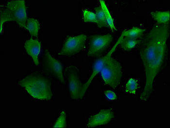 TRIM65 Antibody