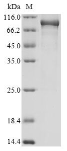 Human Transmembrane protease serine 2 protein
