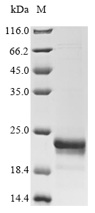 Human FABP5 protein